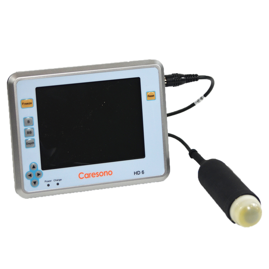 HD6 Ultrasound Battery Charger image 1