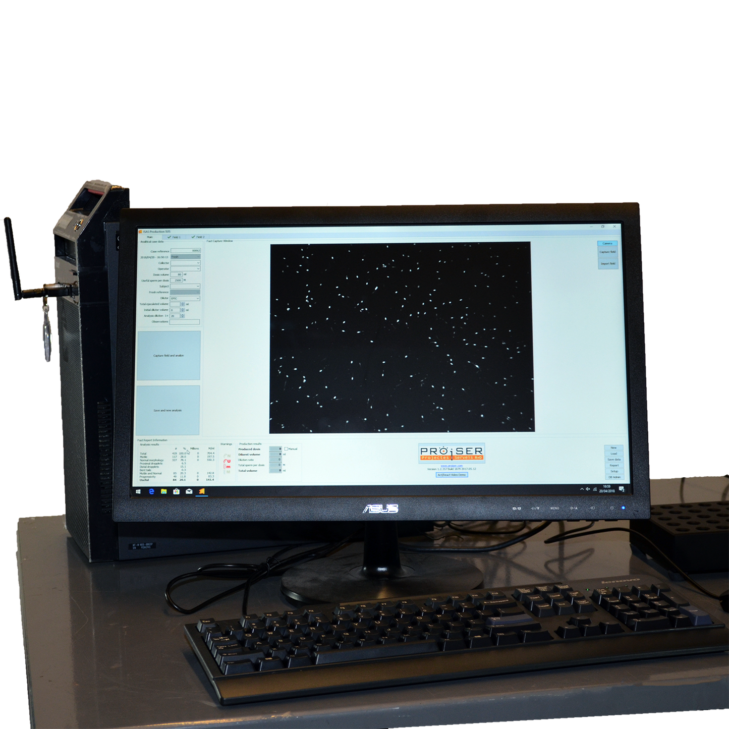 Computer Assisted Semen Analysis System image 2