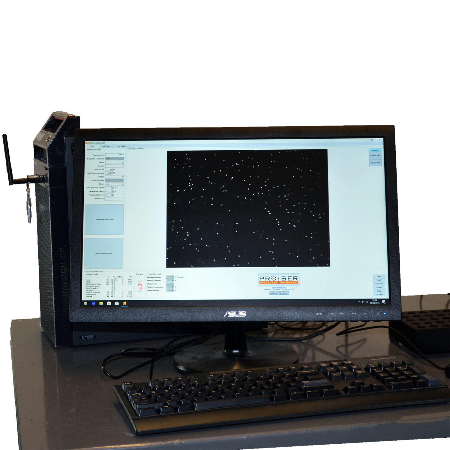 Computer Assisted Semen Analysis System image 2