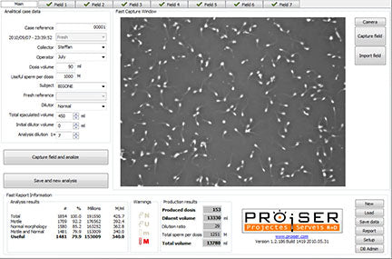 Computer Assisted Semen Analysis System image 3