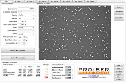 Computer Assisted Semen Analysis System image 3